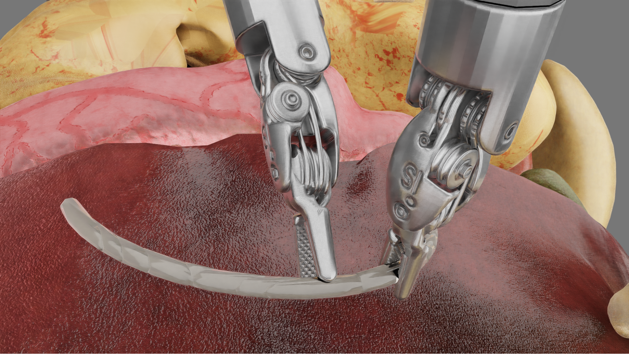 Advancing Surgical Robotics with AI-Driven Simulation and Digital Twin Technology : US Pioneer Global VC DIFCHQ SFO India Singapore – Riyadh Swiss Our Mind